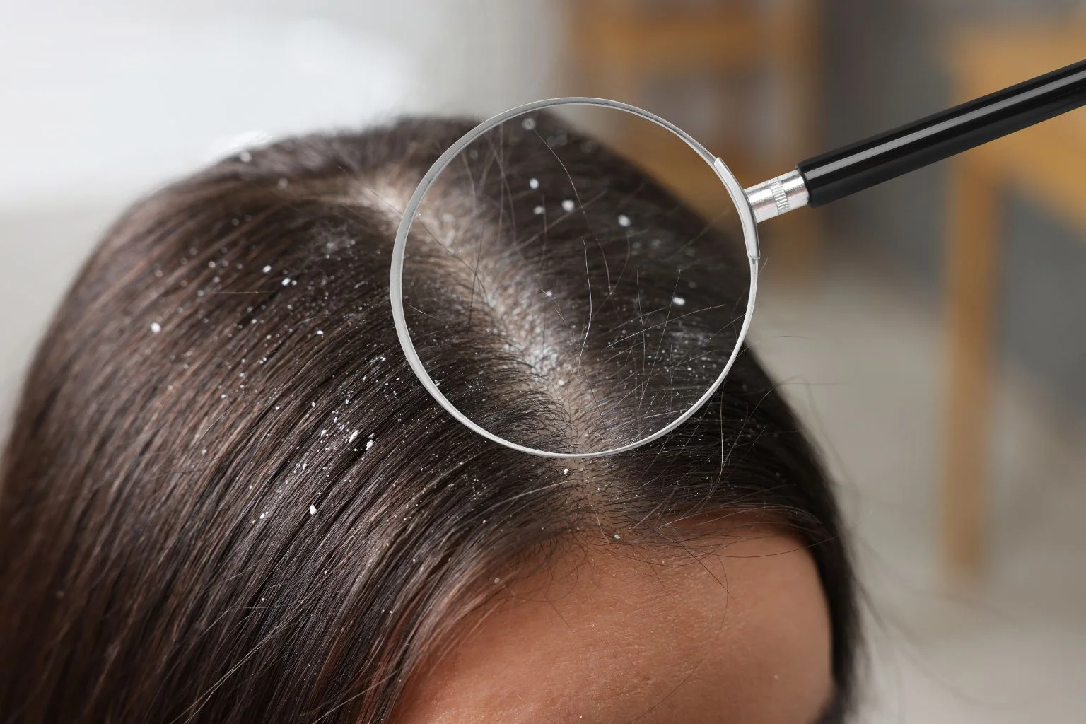 Dandruff & Scalp Treatments